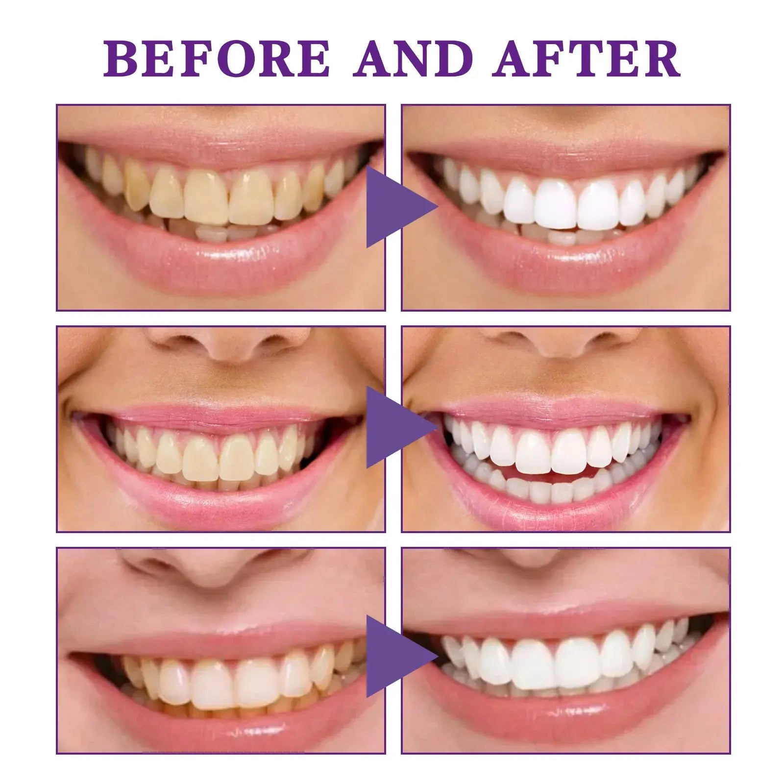 V34 Tooth Cleaning Mousse - Epic Deals USA